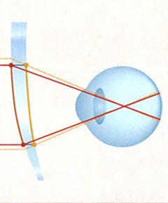 縦方向視野図