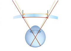 横方向視野図